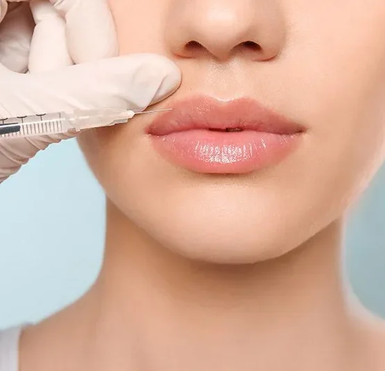 Dermal Fillers