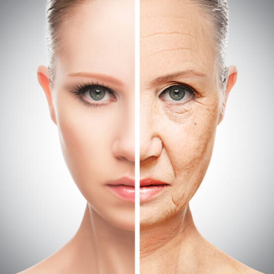 Skin Tightening