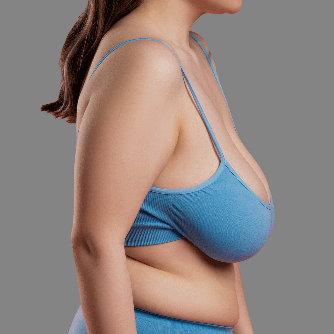 Breast Reduction
