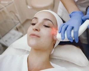 Laser Pigment Reduction on Private Area