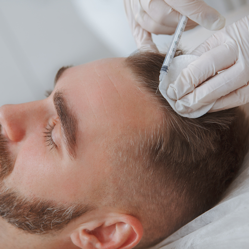 Hair regrowth therapy